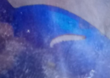 Pais denunciam larvas em merenda oferecida em escola estadual de Salvador