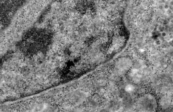 Nova subvariante da covid-19 é identificada em Mato Grosso