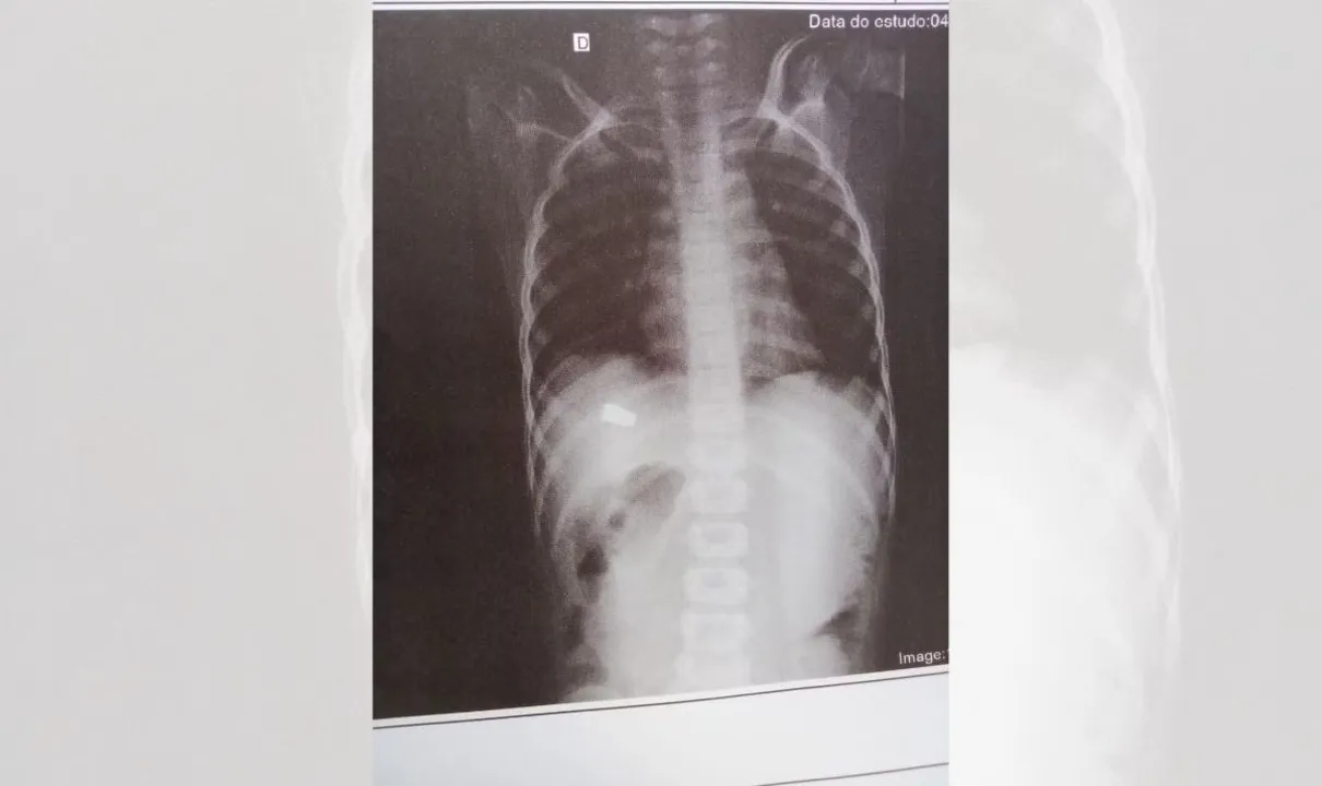 Criança de 8 anos é baleada enquanto brincava dentro de casa na Bahia