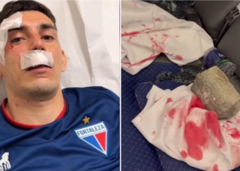 Ônibus do Fortaleza é apedrejado, seis jogadores foram atingidos