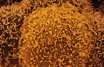 Pesquisa avalia sequelas da covid-19 na população brasileira