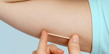 Salvador passa a oferecer Implanon de forma gratuita na rede municipal de saúde